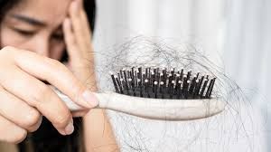 Rụng tóc nhiều – vấn đề không chỉ nằm ở mái tóc