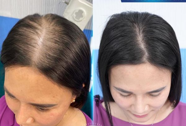 Điểm danh 6 sai lầm cần tránh khi gội đầu