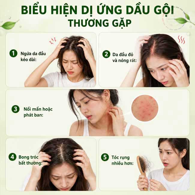 Biểu hiện dị ứng dầu gội thường gặp