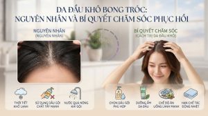 Da-Dau-Kho-Bong-Troc-Nguyen-Nhan-va-Bi-Quyet-Cham-Soc-Phuc-Hoi